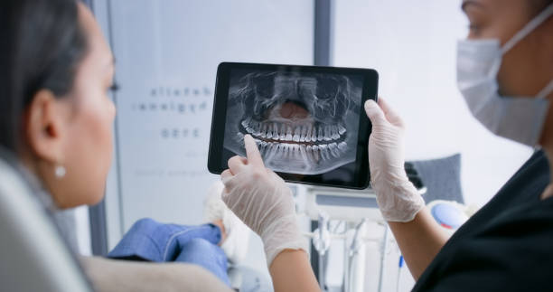 Licensed Tooth Extraction service in McKinney, TX - Smile Center Dentistry